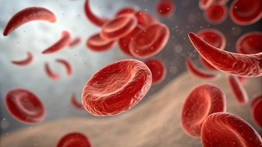 Managing Sickle Cell with Natural Herbs