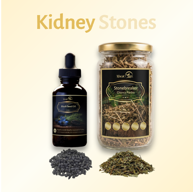 Kidney Stones